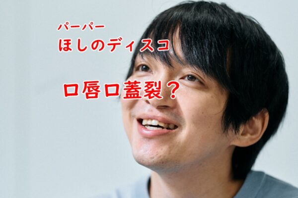 パーパーほしのディスコは口唇口蓋裂 鼻の穴が非対称で曲がってる原因とは ａｓｔｅｒｉｓｋ アスタリスク